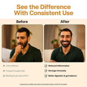 Ginger & Turmeric + Probiotic Gummies