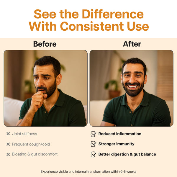 Ginger & Turmeric + Probiotic Gummies